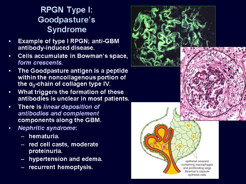 RENAL PATHOLOGY Greg Balko, MD May 27, 2009