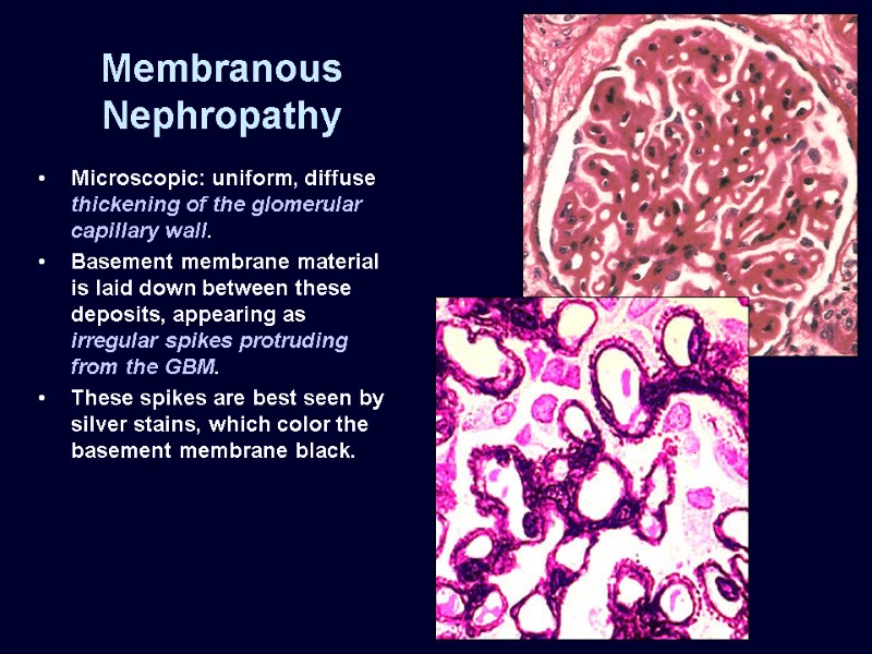 RENAL PATHOLOGY Greg Balko, MD May 27, 2009