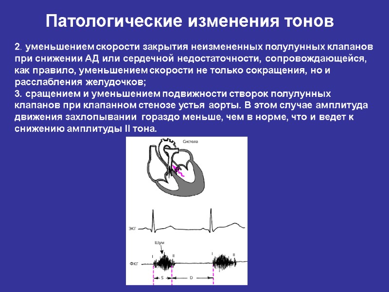 Точки выслушивания клапанов сердца