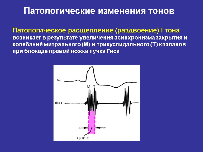 Точки аускультации клапанов сердца