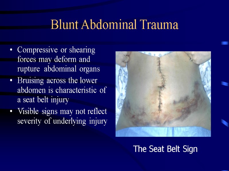 signs and symptoms of blunt abdominal trauma