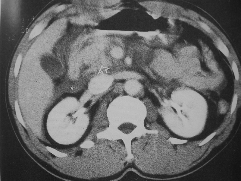 Abdominal Trauma Rambam Medical Center Dr Nordkin Dmitri