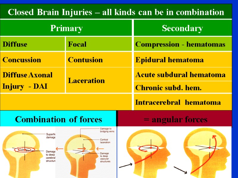 Craniocerebral Injury Jaroslav Plas Dept Of Neurosurgery 1st craniocerebral-injury-jaroslav-plas-dept-of-neurosurgery-1st