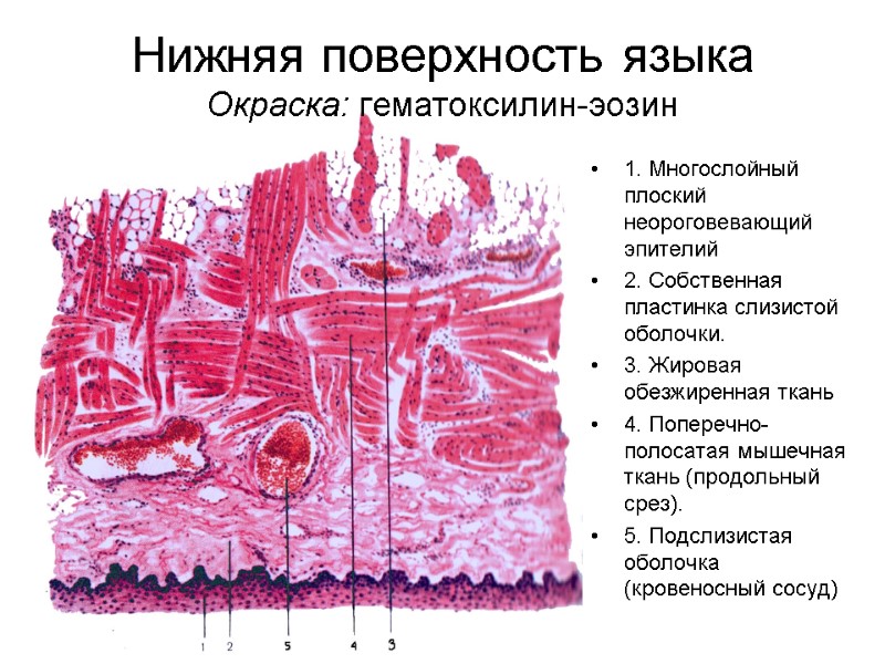 Атрофия сосочков языка фото