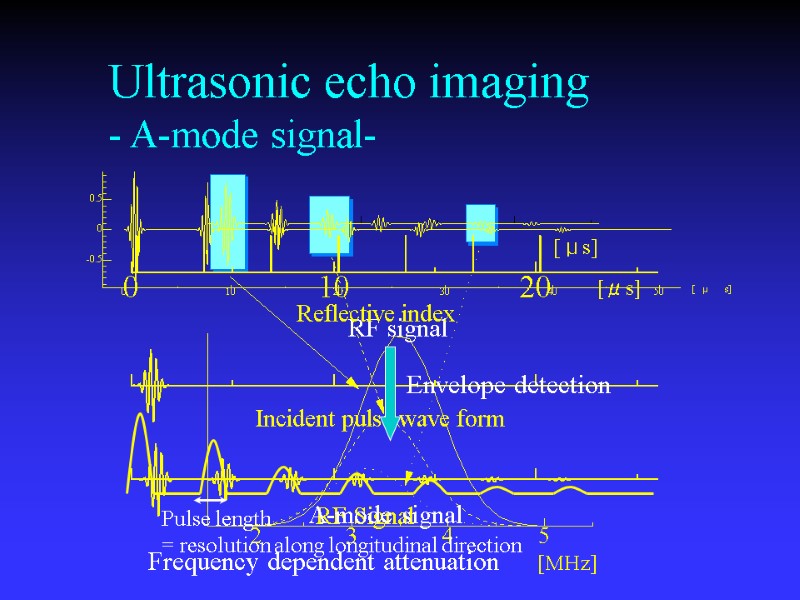 Foundations Of Medical Ultrasonic Imaging Physics Of Ultrasound