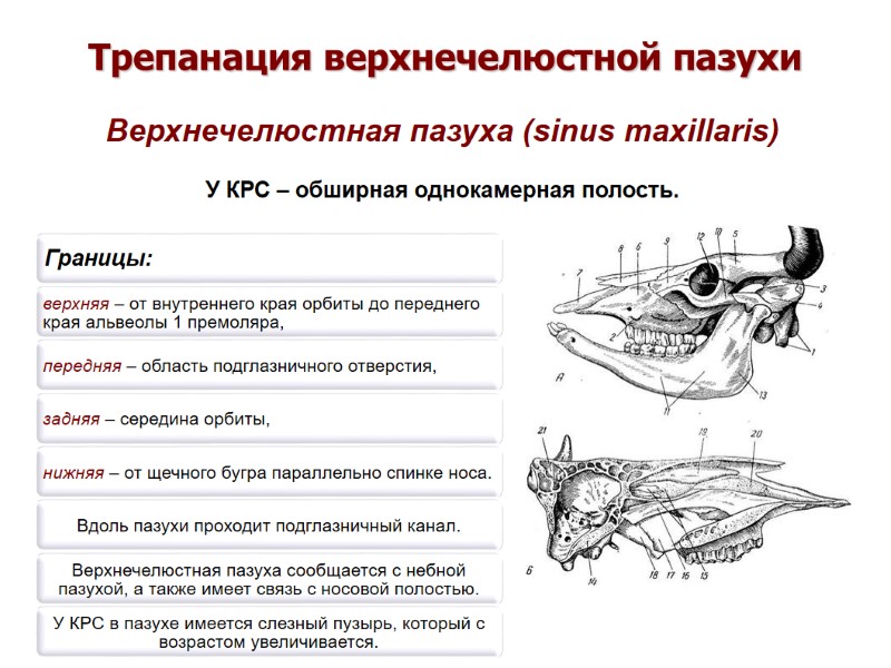 Правая верхнечелюстная пазуха где находится картинка