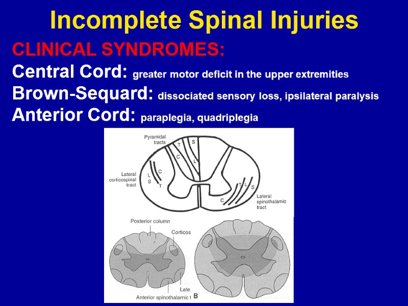 Spinal Injuries M. Jamous M.D. Spinal Injuries Incidence