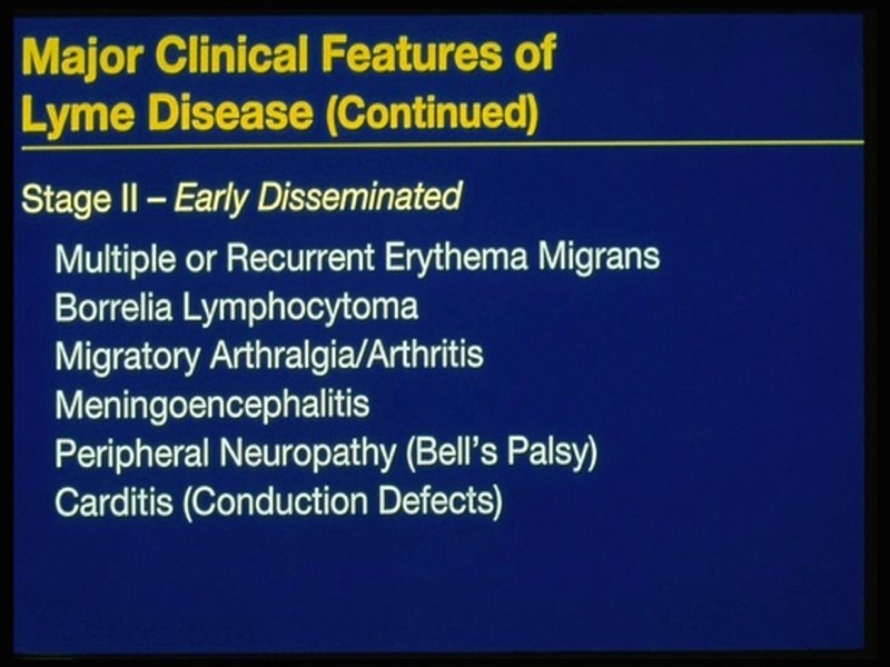 SEPTIC ARTHRITIS RAPID JOINT DESTRUCTION SERIOUS CAUSE OF