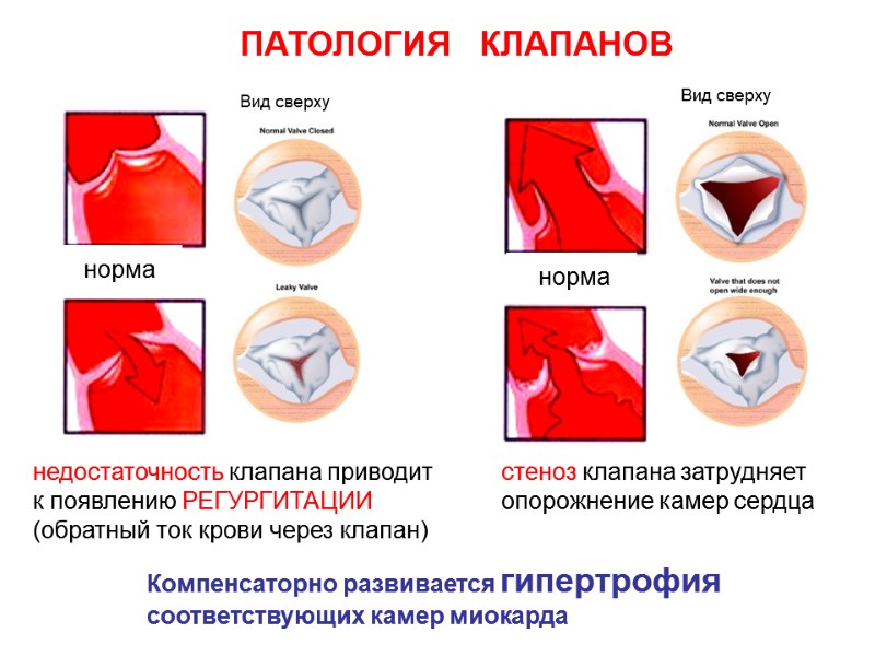 Закрылся сердечный клапан причины