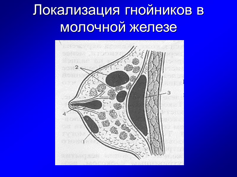 Молочная железа в разрезе фото