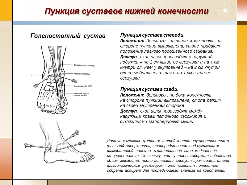 Ушиб голеностопного сустава карта вызова