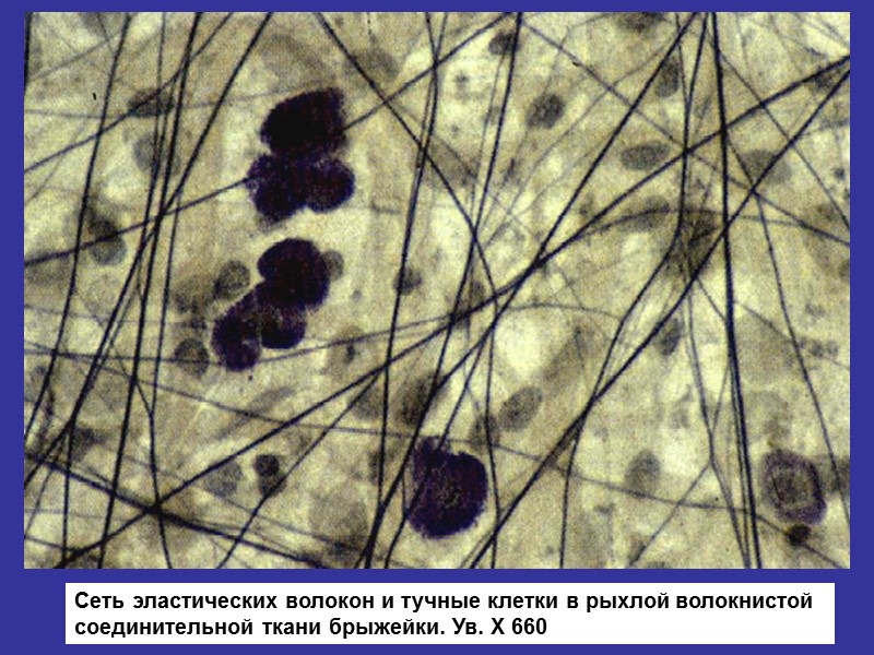 Рыхлая волокнистая соединительная ткань гистология рисунок