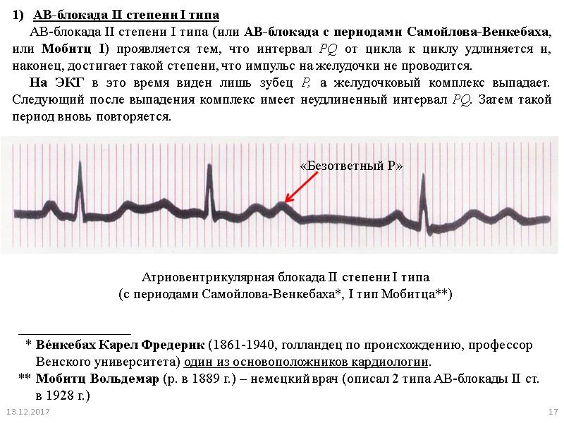 Блокада инструкция. AВ блокады 2 степени с периодами Самойлова Венкебаха. Атриовентрикулярная блокада II степени (Тип i Мобитца). Периоды Самойлова-Венкебаха на ЭКГ. АВ-блокада 2 степени с периодами Самойлова Венкебаха на ЭКГ.