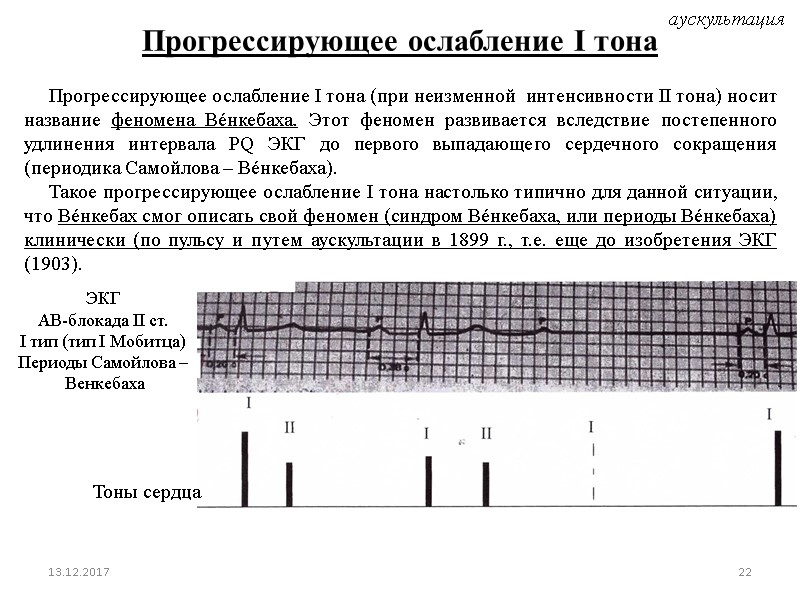 Экг презентация пропедевтика