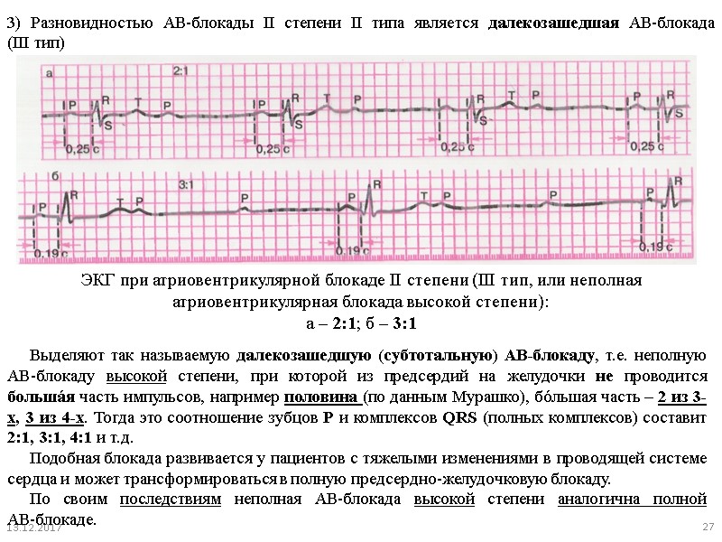 Ав блокады картинки