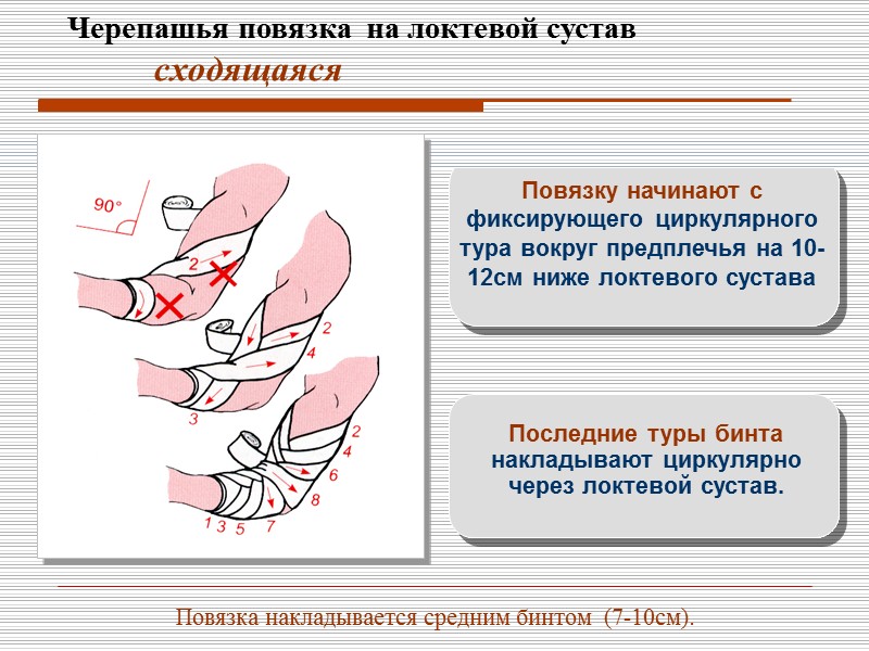 Литература: 1. Техника наложения повязок. М.Земан, Санкт-Петербург., 1994г.   2. Первая медицинская помощь