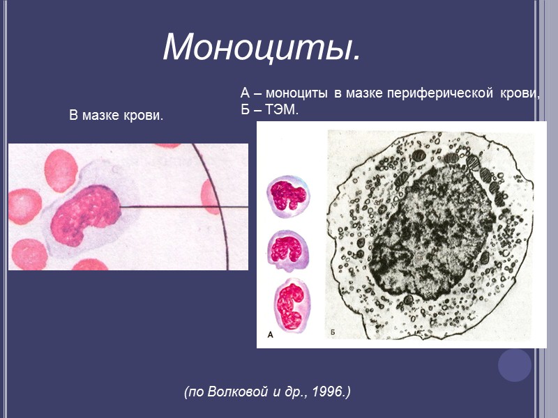 Моноцитов в крови 1. Моноциты в периферической крови.. Моноцит гистология препарат. Моноциты в мазке крови. Моноциты в периферической крови мазка.