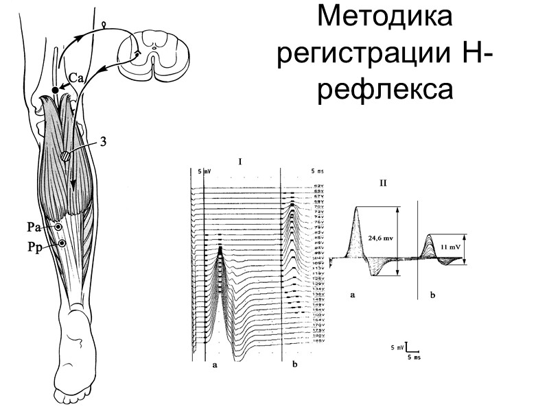Параметры М-ответа m.orbicularis oculi и мигательного рефлекса в норме