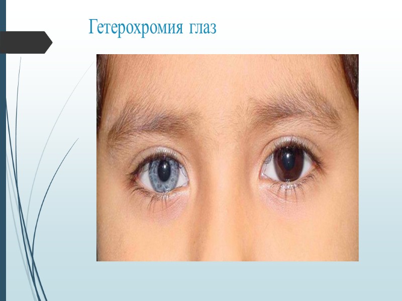 Возрастные особенности спинного мозга У новорожденного спинной мозг составляет в длину 14 см, к