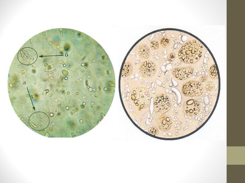 А) Пневмококк (диплококк Френкеля) (Pneumococcus). Пневмококк. Диплококк ланцетовидной формы. Два кокка, из которых он