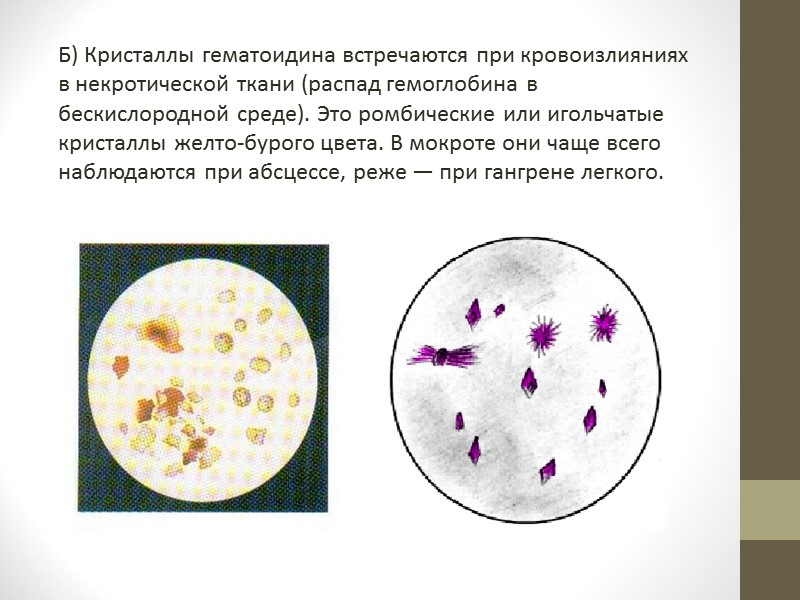 Микобактерии или разбросаны по препарату единичными экземпляра или встречаются небольшими кучками. Длина их различна