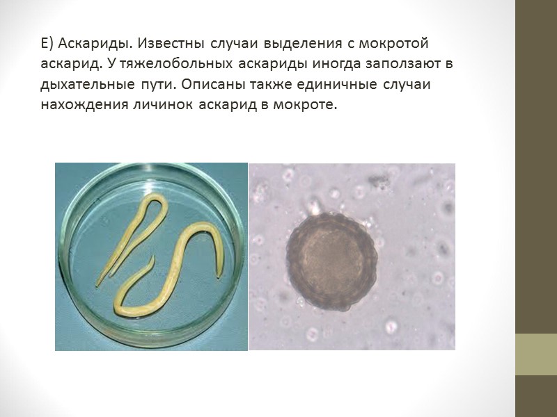 Cryptococcus neoformans Рекомендуется нативное исследование с тушью. Микроорганизм выглядит как единичная почкующаяся бластоспора, от