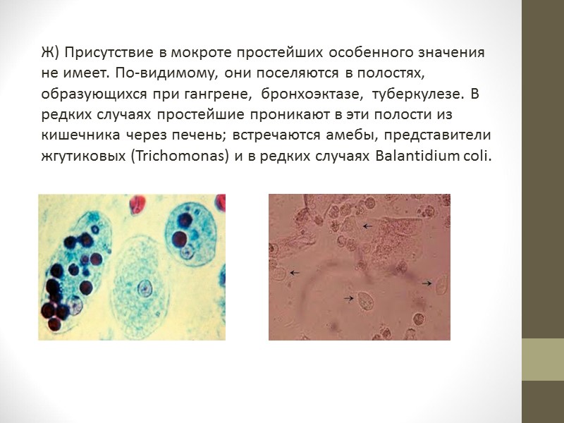 Histoplasma capsulatum В мокроте, окрашенной по Романовскому— Гимзе, выявляются макрофаги с характерными внутриклеточными мелкими