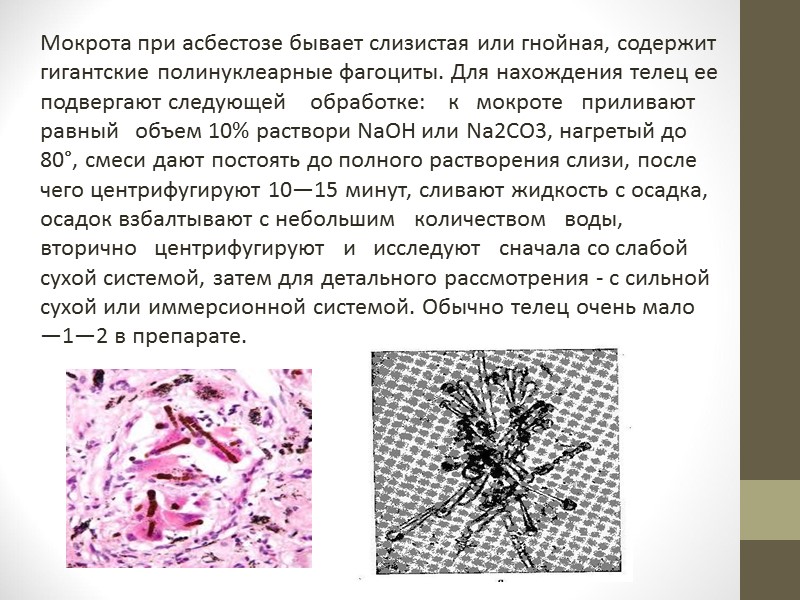 Candida albicans  Относится к роду Candida, является сапрофитом слизистых оболочек рта, кишечника, влагалища,