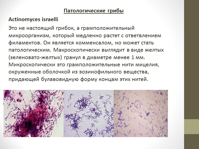 включения, патологические элементы, паразиты в мокроте спирали Куршмана в виде небольших плотных извитых беловатых