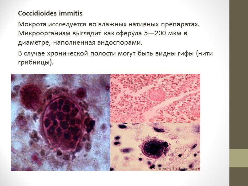 В) Бокаловидные клетки выделяют слизистый секрет. Вместе с клетками цилиндрического мерцательного эпителия осуществляют мукоцилиарный