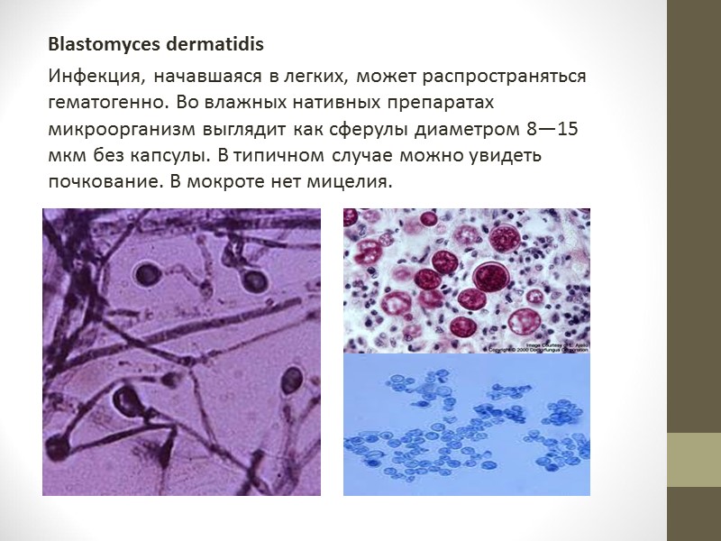 Ciliated cells – реснитчатый эпителий Globet cells – бокаловидные клетки Basal cells – базальные