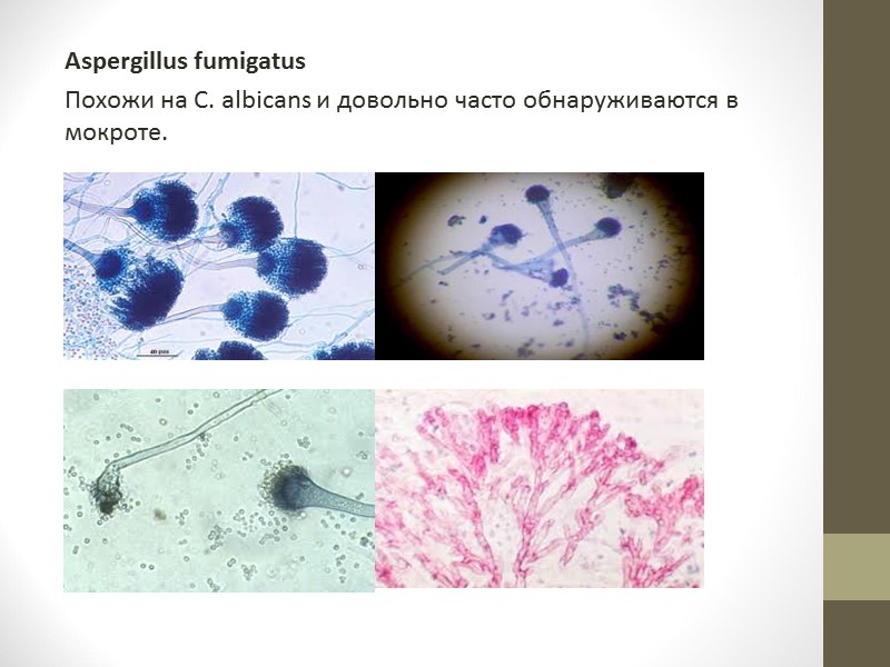 Д) Нейтрофильные гранулоциты при большом увеличении имеют вид округлых, иногда неправильной формы клеток диаметром