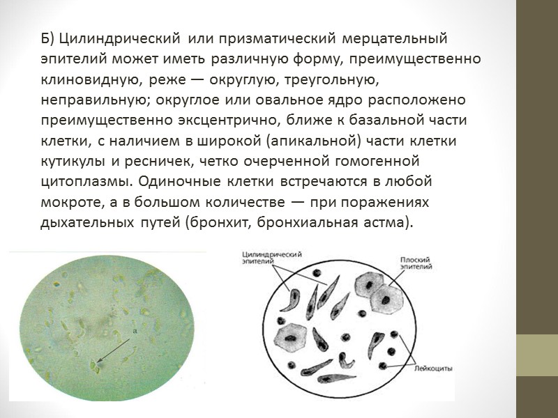 Б) Дрожжевые грибы рода Candida — почкующиеся клетки и короткие почкующиеся нити псевдомицелия (клетки