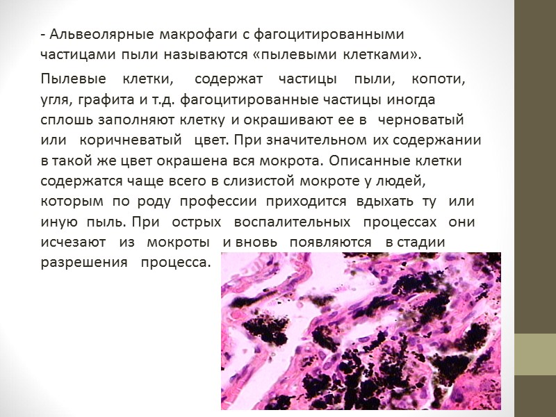 1) клеточные элементы  Лейкоциты. В мокроте встречаются те же виды лейкоцитов, что и