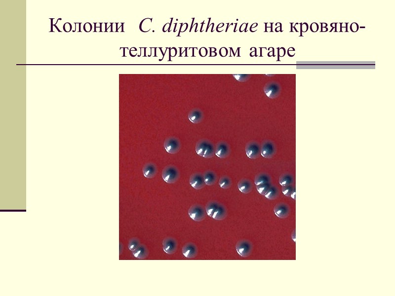 Общая характеристика рода Corynebacterium Гр+ палочки,  неподвижные, бесспоровые факультативные анаэробы, каталаза+ особое химическое