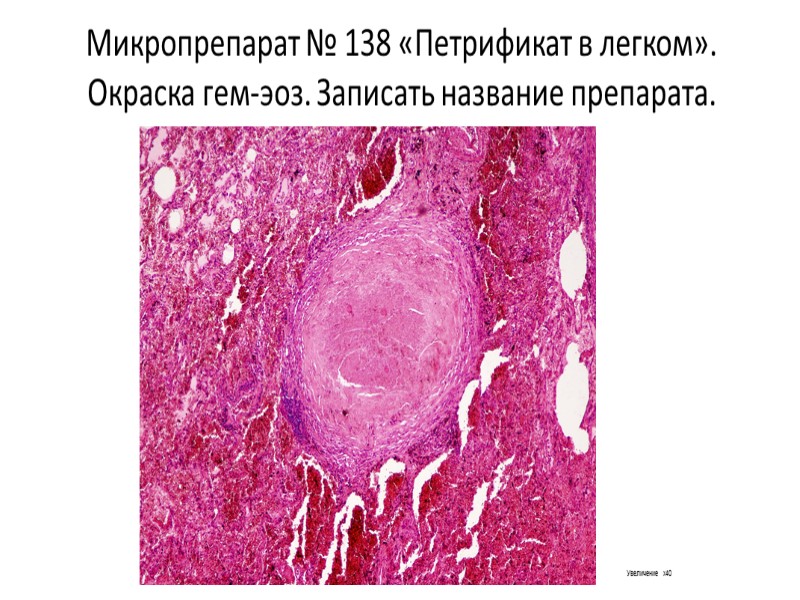 Микропрепарат № 25  «Гемосидероз печени»  (реакция Перлса на железо) . Препарат описать