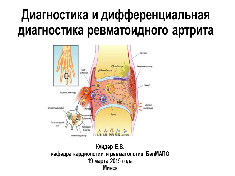 Диагностика и дифференциальная диагностика ревматоидного артрита Кундер Е.В. кафедра кардиологии и ревматологии БелМАПО 19