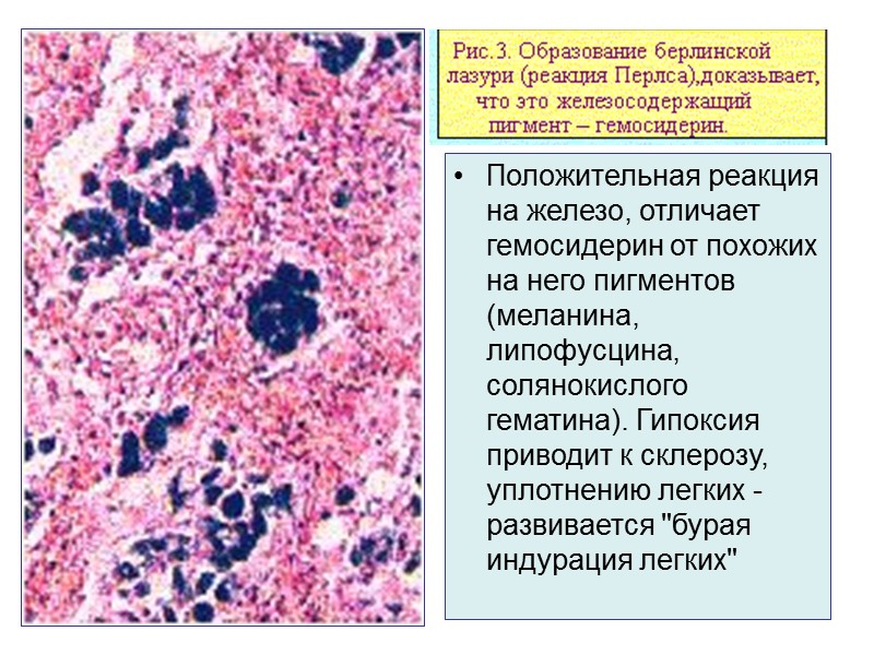 Классификация эндогенных пигментов (часто встречающихся)