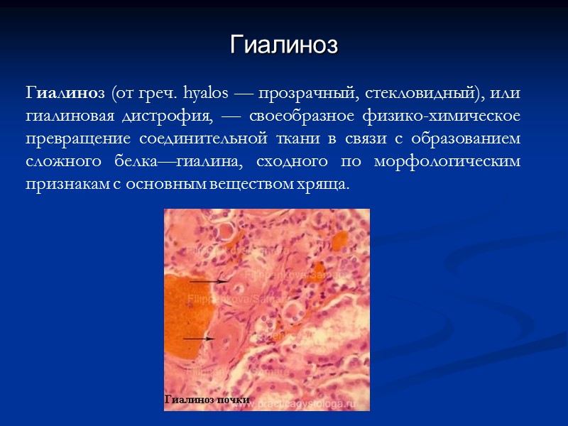 Гиалиноз относится к. Гиалиноз почки препарат. Гиалиноз капельная дистрофия. Гиалиноз патологическая анатомия.