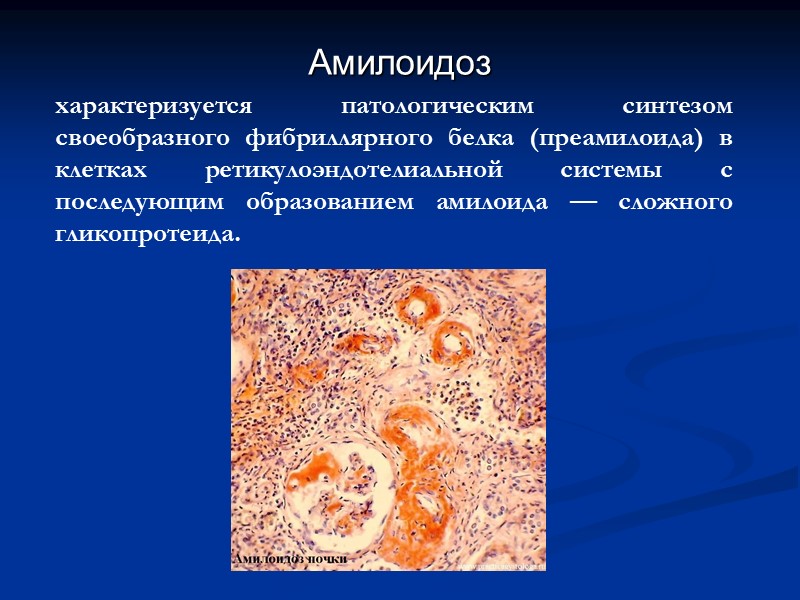 Амилоидоз почки рисунок