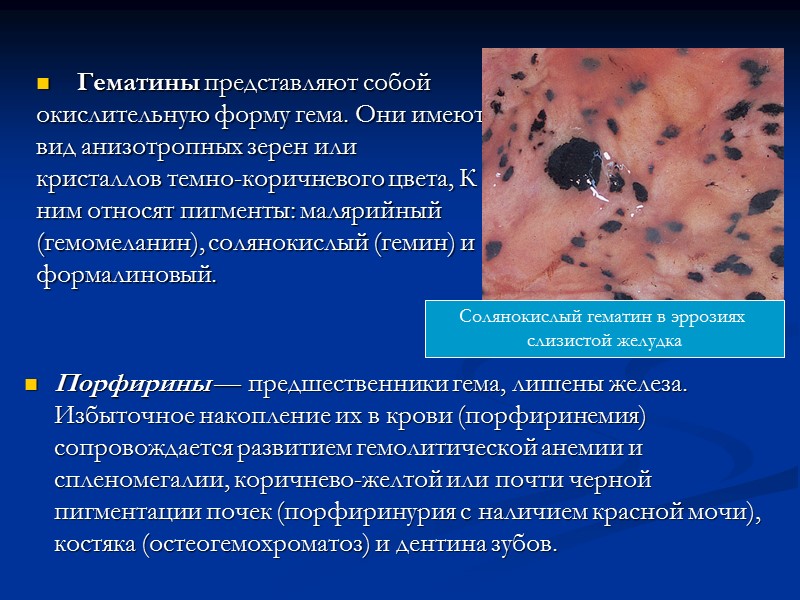 Амилоидоз характеризуется патологическим синтезом своеобразного фибриллярного белка (преамилоида) в клетках ретикулоэндотелиальной системы с последующим