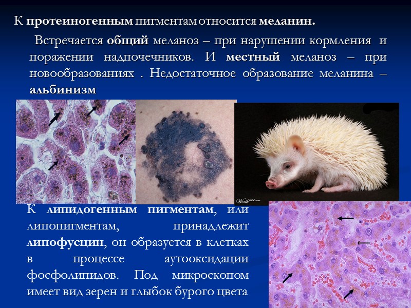 Смешанные дистрофии проявляются структурными изменениями как в клетках, так и в межклеточном веществе 