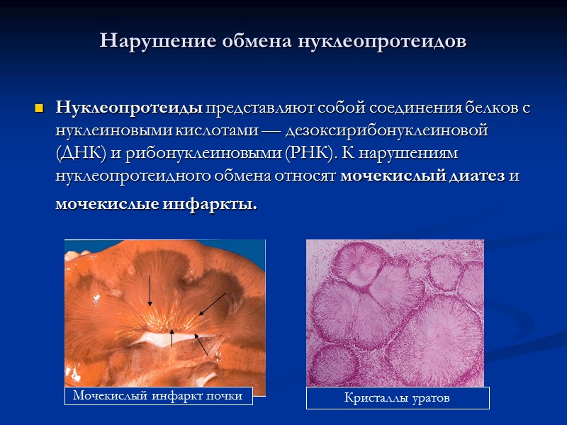 Гемолитическую желтуху отмечают при заболеваниях крови, инфекциях и интоксикациях, вызывающих распад эритроцитов с образованием