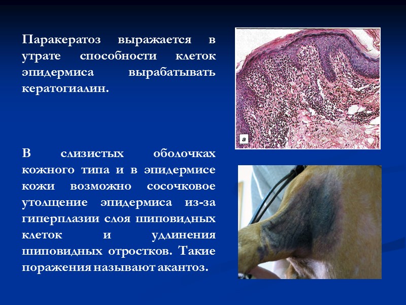 Классификация дистрофий По преимущественной локализации изменений:   Паренхиматозные (внутриклеточные)   Стромально-сосудистые (мезенхимальные,
