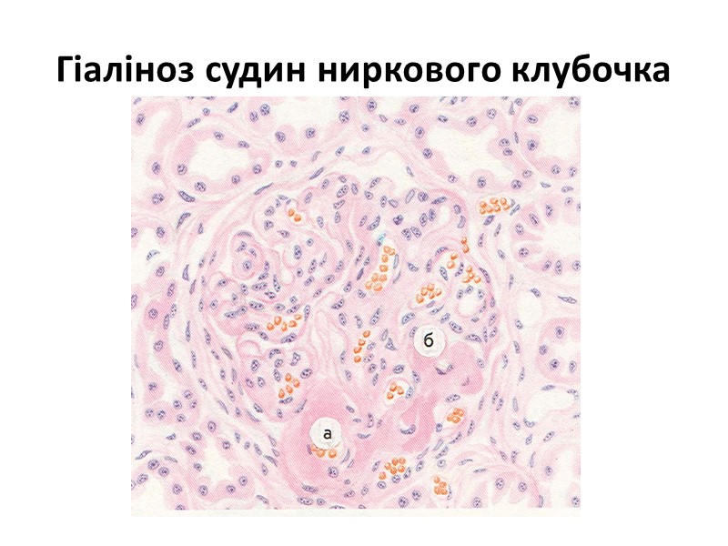 Класифікація дистрофій: білкові;  жирові;  вуглеводні; мінеральні; паренхіматозні (зміни в клітинах);  мезенхімальні