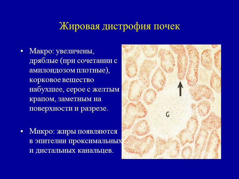 Презентация на тему дистрофия