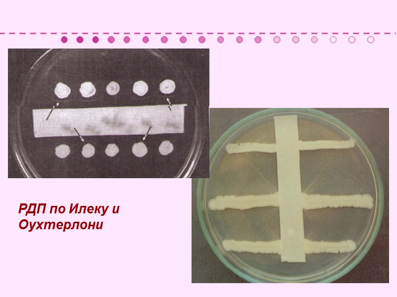 Дифференциация дифтерийной палочки от дифтероидов
