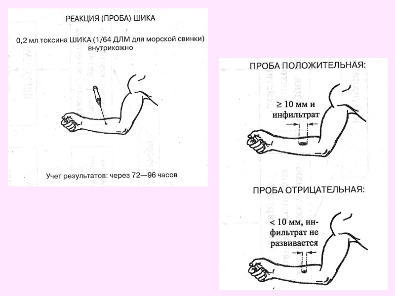 Антигенная структура О-антиген – групповой, липополисахарид клеточной стенки, термостабильный. К-антиген – типовой, представлен капсульными