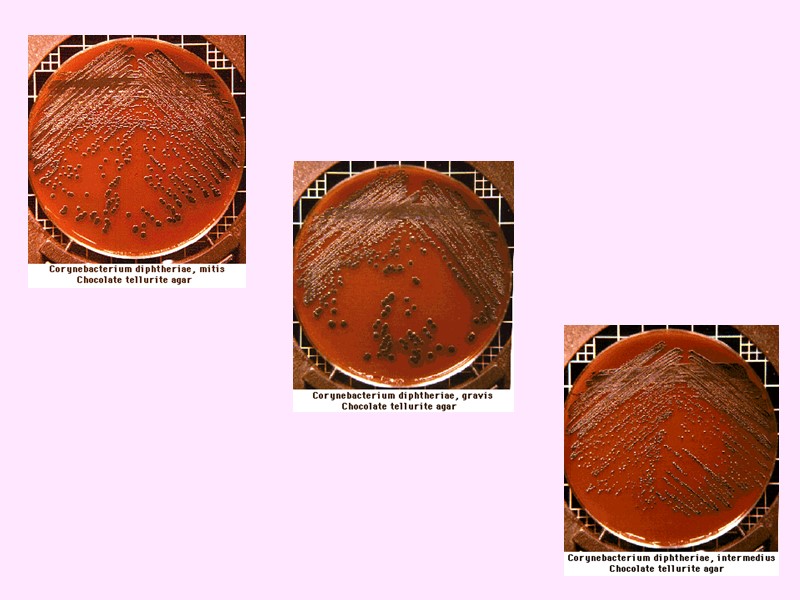 Историческая  справка  1883 г.:  Э. Клебс –  открытие возбудителя дифтерии.