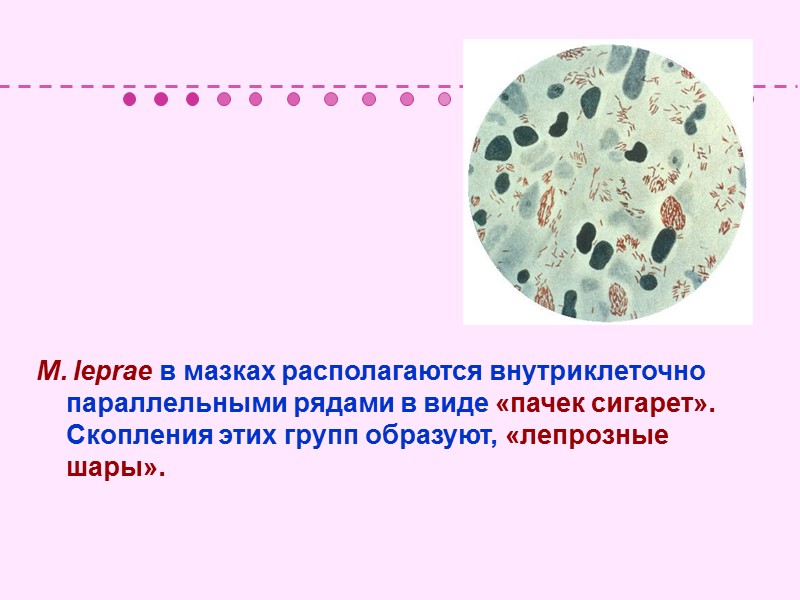 Оценка пробы Манту с 2 ТЕ  (Через 48-72 часа)  Отрицательная – уколочная